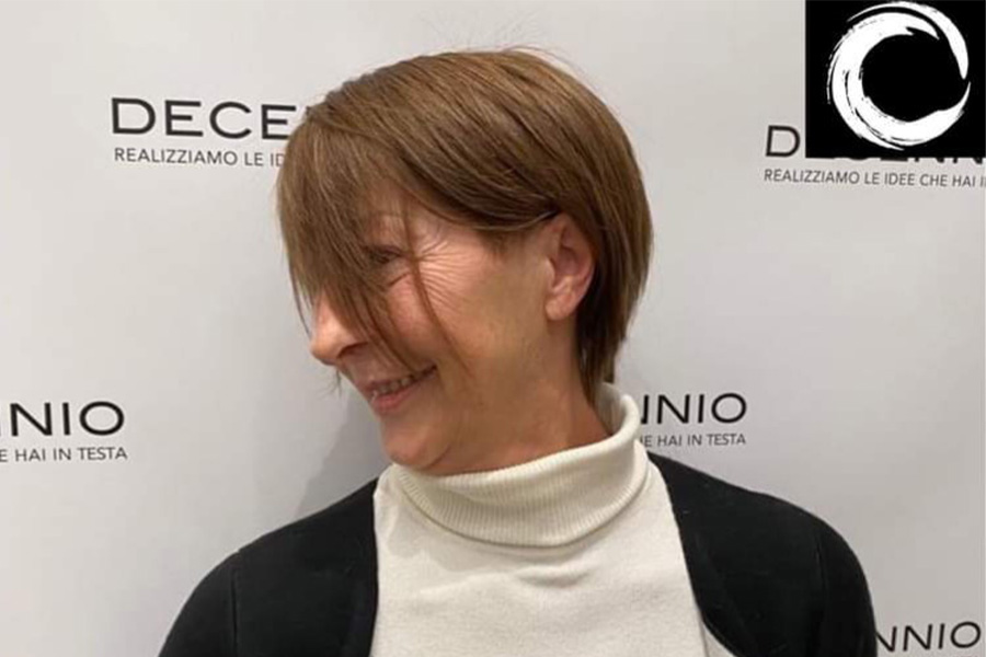 calvizie femminile