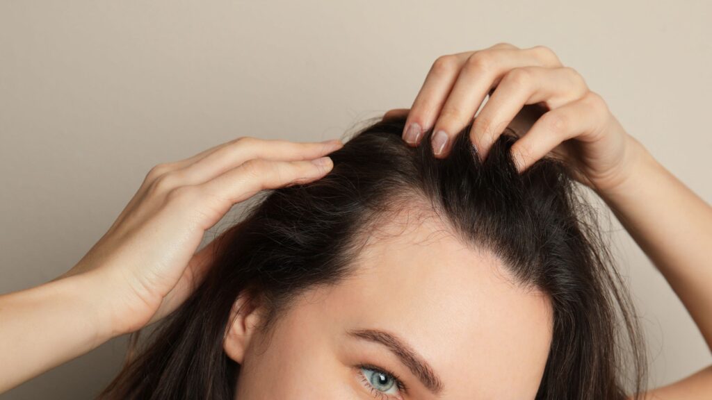 Caduta di capelli: cause e soluzioni